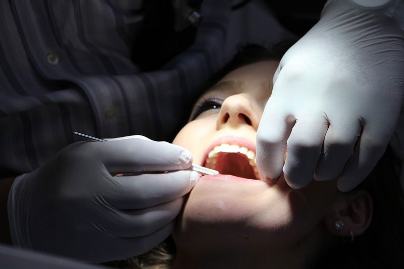 Dental hygiene - Professional dental cleaning
